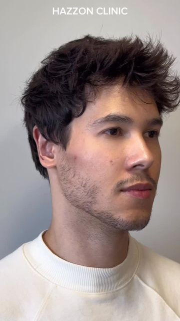 Criativo da Hazzon: Harmonização masculina