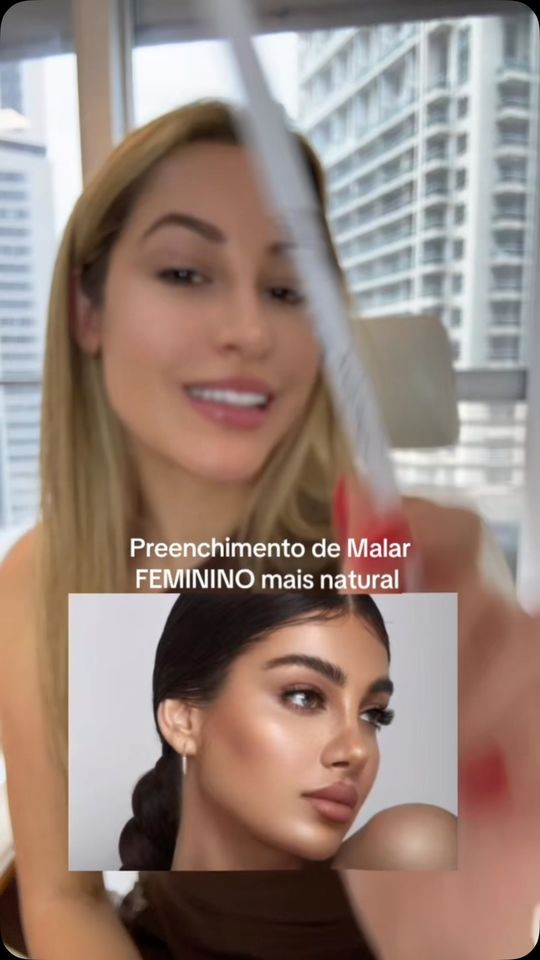 Preenchimento de malar