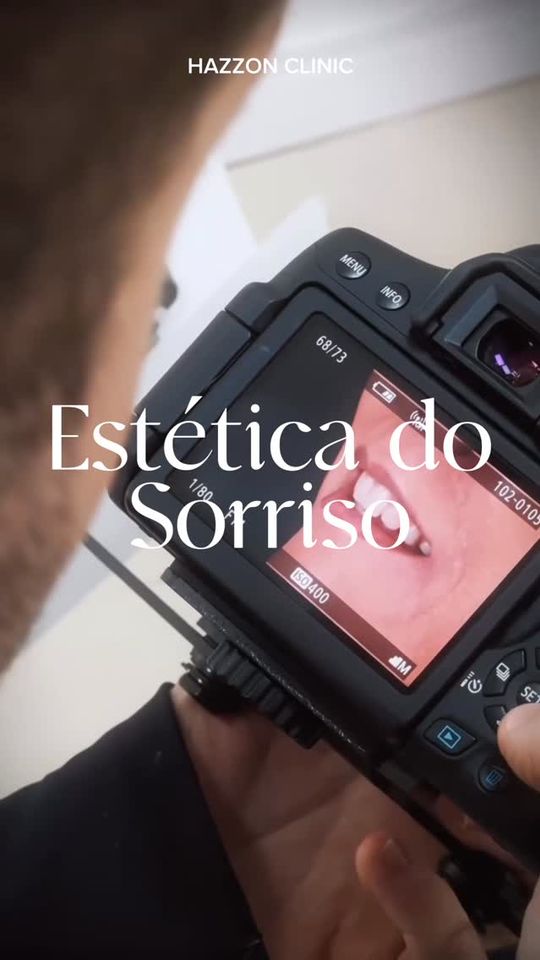 Estética do sorriso